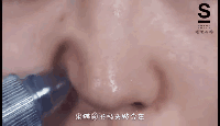 New&New|焕颜美容仪爆款去黑头神器！3分钟搞定多年顽固黑头！
