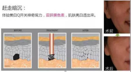 恒和白瓷娃娃—让你素颜也是“肤白貌美”！